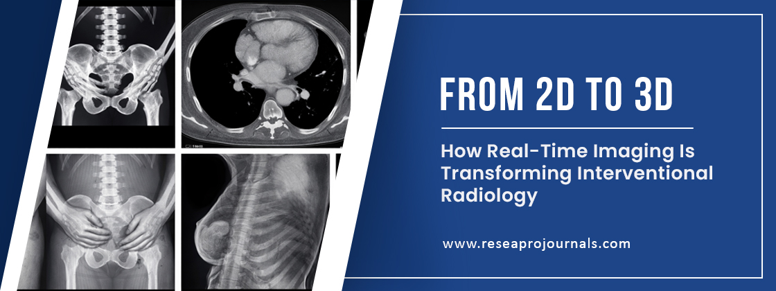 From 2D to 3D: How Real-Time Imaging Is Transforming Interventional Radiology